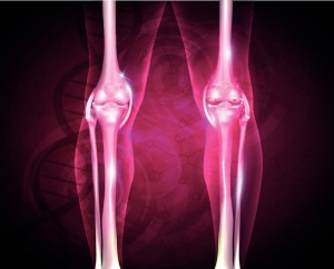 arthrose (2)